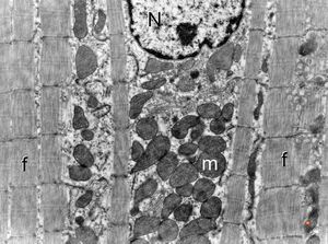  normal cardiomyocyte … longitudinal section(N - nucleus, m … mitochondria, f - myofilaments)
